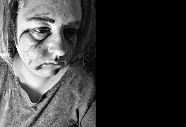 Schwarzes und weißes Foto einer Frau mit Gesichtsverletzungen, ernstem Gesichtsausdruck, konzentriertem Blick, zurückgebundenem Haar und einem T-Shirt.